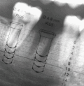 Screenshot of Implants Hongrie 1.00023