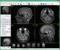 Medical imaging automation package