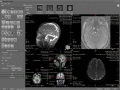 Screenshot of ORS Visual Lite 1.5.1
